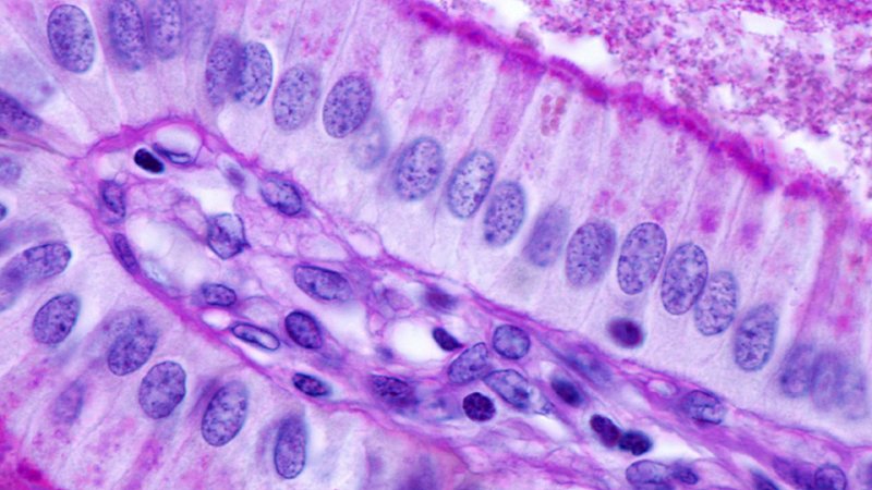 Cellule eucariote