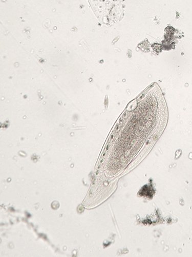 Ciliated protozoan Ciliophora