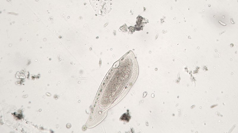 Protozoo ciliato Ciliophora