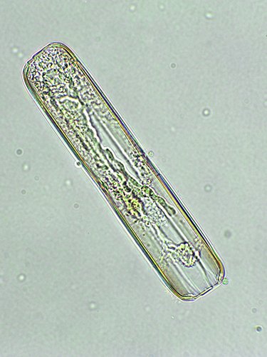 Unicellular alga