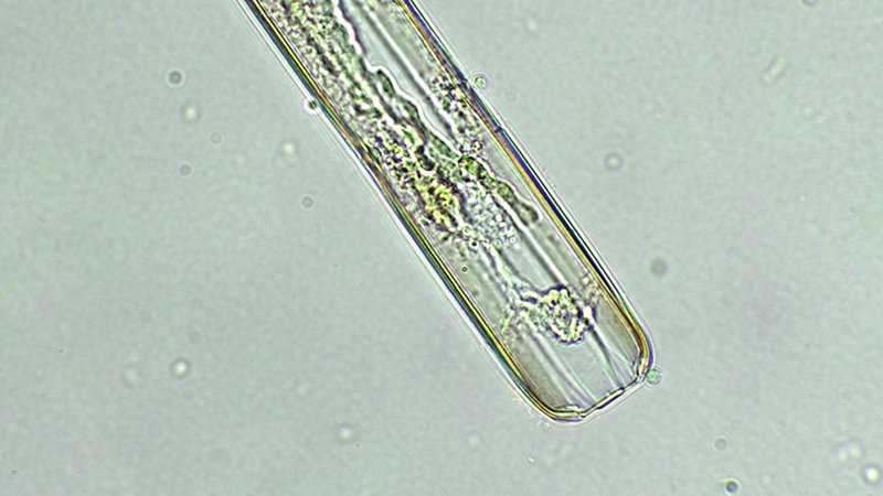 Unicellular alga