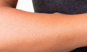 La musica della pelle d’oca