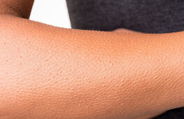 La musica della pelle d’oca