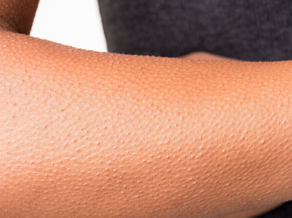 Goosebumps music