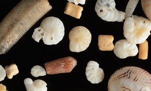 Grains under the microscope