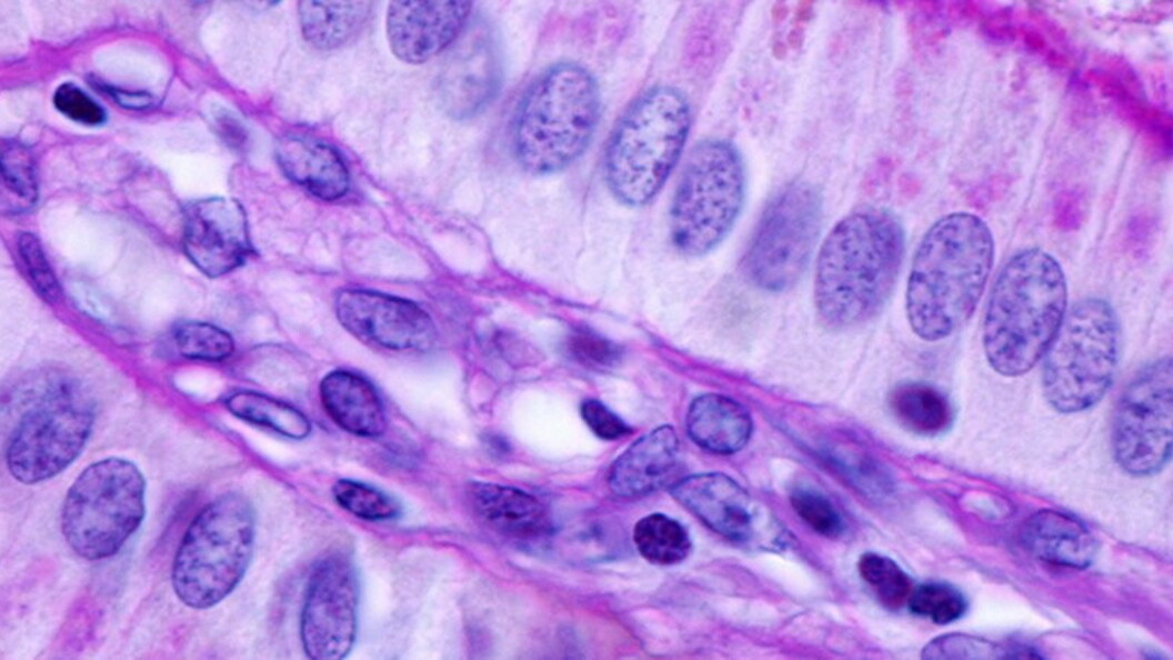 Cellule eucariote
