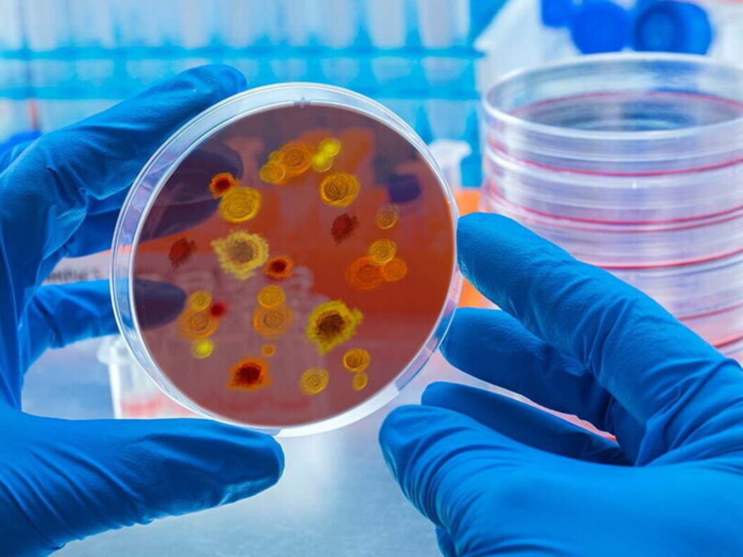 Coltura batterica matura