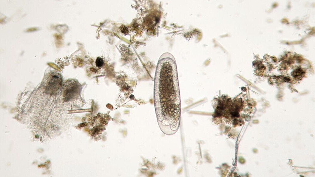 Protozoo acquatico