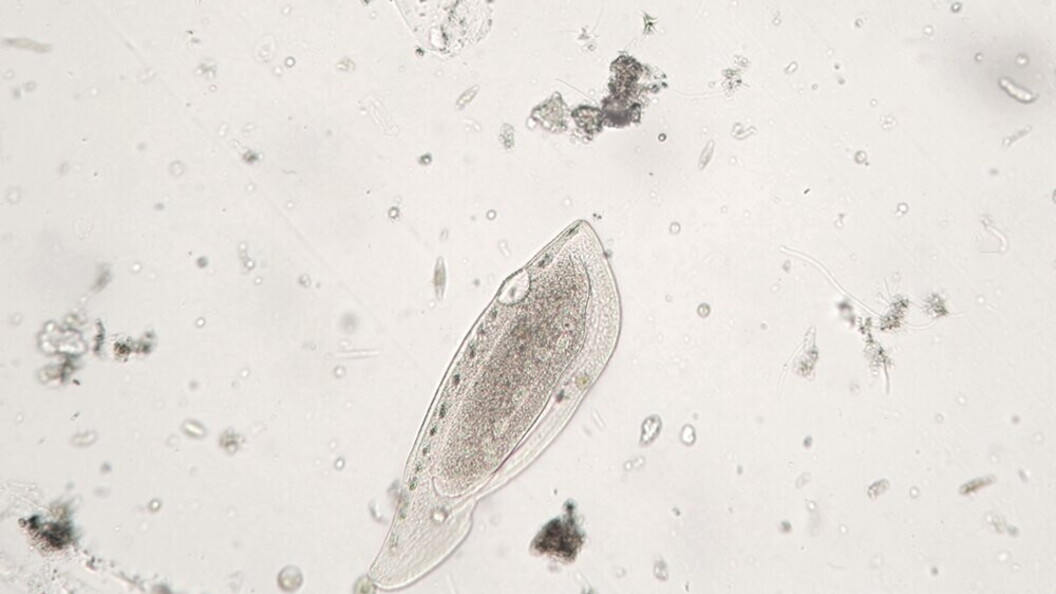 Protozoo ciliato Ciliophora