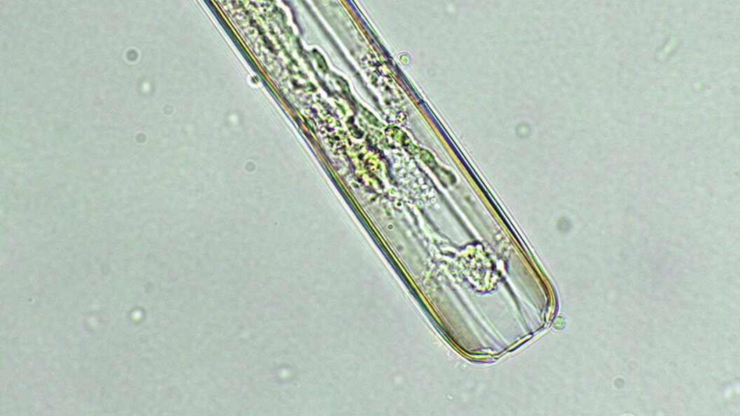 Alga unicellulare
