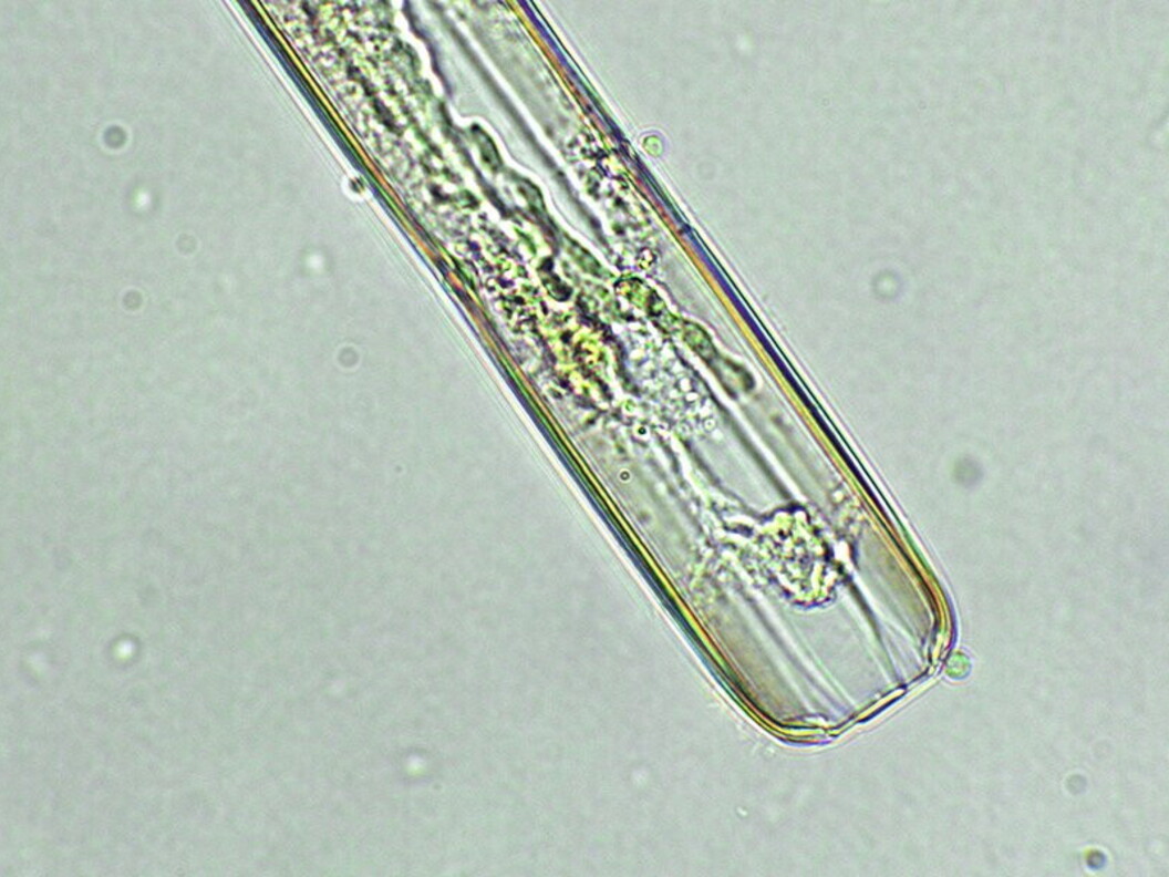 Alga unicellulare