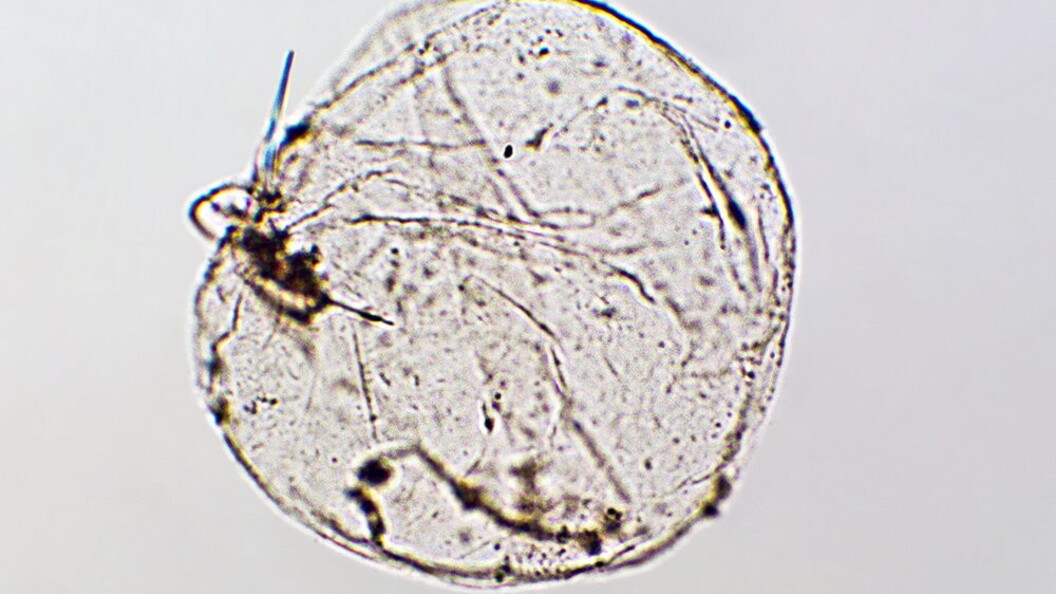 Noctiluca scintillans