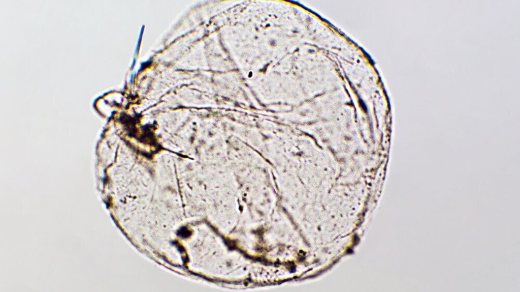 Noctiluca scintillans