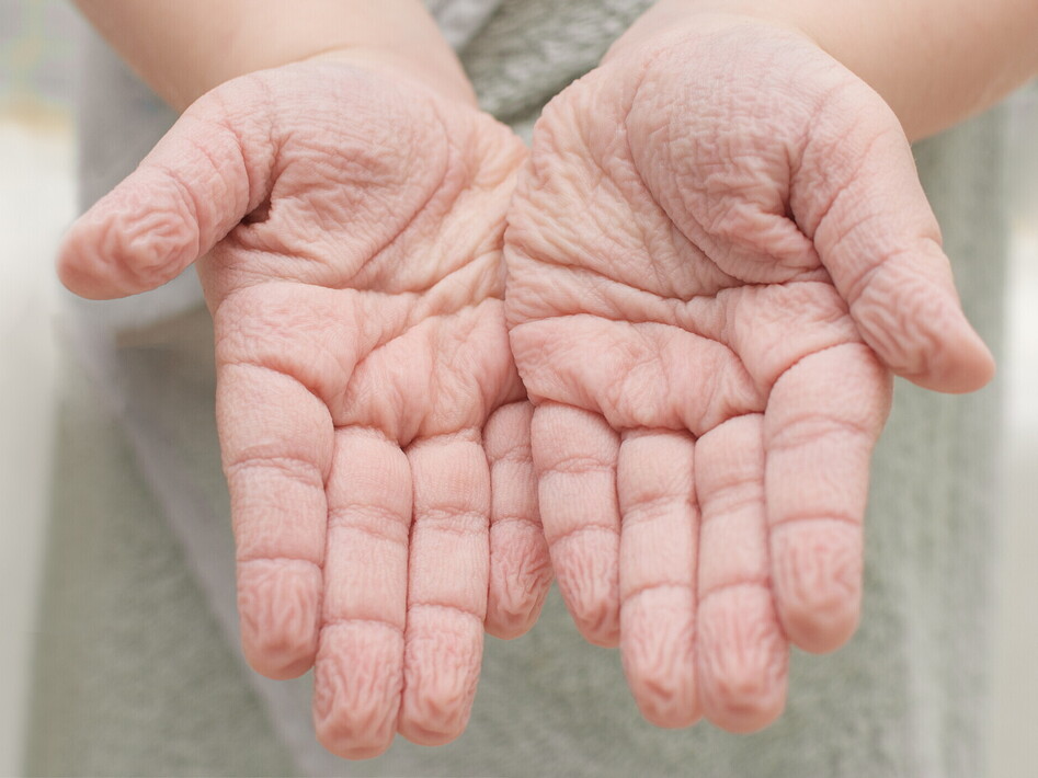 Svelato il mistero delle “dita lesse”