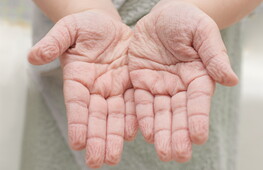 The mystery of “pruney fingers” revealed