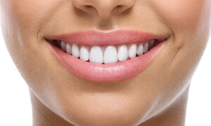 Cosa sono i denti?