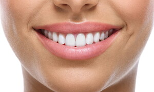 Cosa sono i denti?